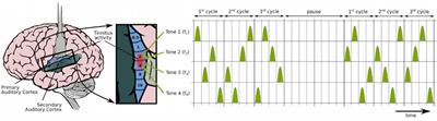 Acoustic Coordinated Reset Neuromodulation: A Systematic Review of a Novel Therapy for Tinnitus